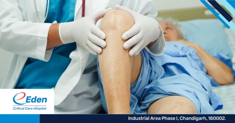 Knee Replacement in Chandigarh: 6 Things Most Patients Miss!